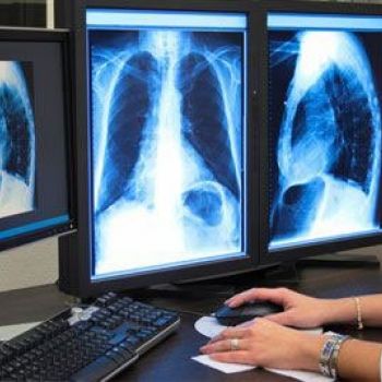 centro radiodiagnostico castellon6