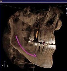 TAC Dental Galileos